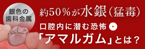 約50％が水銀（猛毒）口腔内に潜む恐怖「アマルガム」とは？