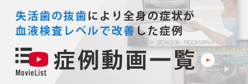 失活歯の抜歯により全身の症状が血液検査レベルで改善した症例 症例動画一覧