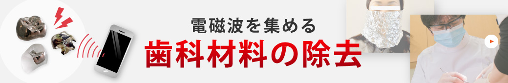 電磁波を集める歯科材料の除去