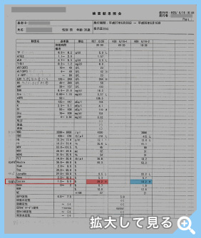 術前：血液検査結果 拡大して見る