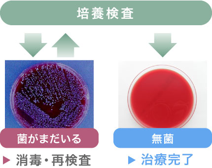 培養検査