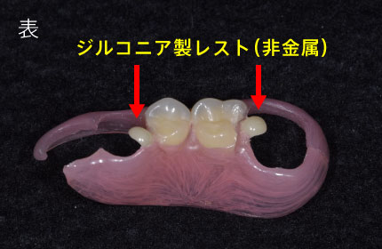 表/ジルコニア製レスト（非金属）