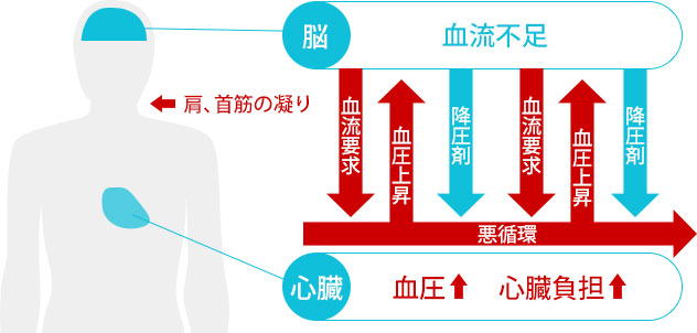 血流不足 血圧 心臓負担 肩、首筋の凝り 降圧剤 血圧上昇 血流要求 脳 心臓