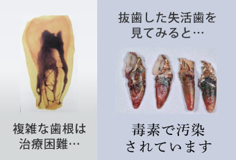 歯科領域が盲点