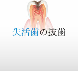 失活歯の抜歯