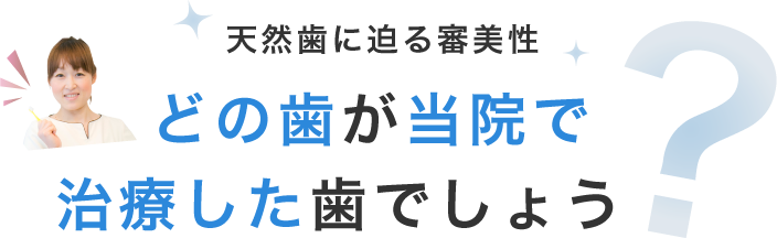 天然歯に迫る審美性どの歯が当院で治療した歯でしょう