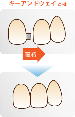 キーアンドウェイとは