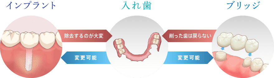 インプラント/入れ歯/ブリッジ