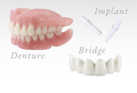 Denture/Implant/Bridge