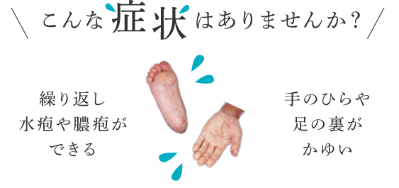 繰り返し水疱や膿疱ができる/手のひらや足の裏がかゆい